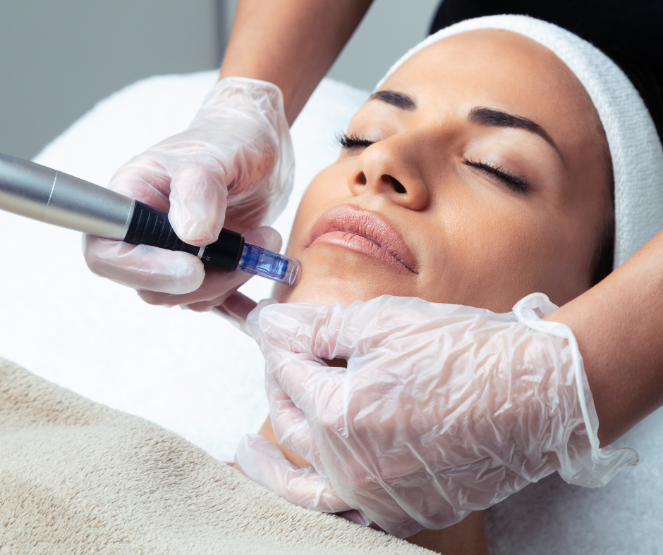 Microneedling